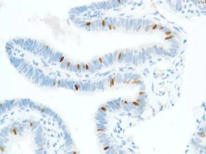 Immunohistochemistry (Formalin/PFA-fixed paraffin-embedded sections) - Anti-SOX2 antibody [SP76] - N-terminal, prediluted (AB101547)