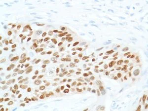 Immunohistochemistry (Formalin/PFA-fixed paraffin-embedded sections) - Anti-SOX2 antibody [SP76] - N-terminal, prediluted (AB101547)
