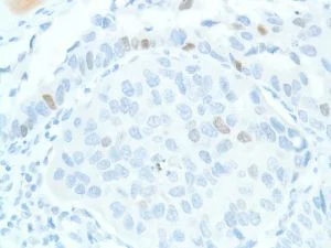 Immunohistochemistry (Formalin/PFA-fixed paraffin-embedded sections) - Anti-SOX2 antibody [SP76] - N-terminal, prediluted (AB101547)