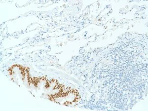 Immunohistochemistry (Formalin/PFA-fixed paraffin-embedded sections) - Anti-SOX2 antibody [SP76] - N-terminal, prediluted (AB101547)
