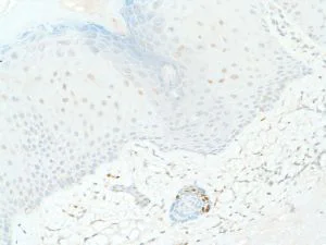 Immunohistochemistry (Formalin/PFA-fixed paraffin-embedded sections) - Anti-SOX2 antibody [SP76] - N-terminal, prediluted (AB101547)
