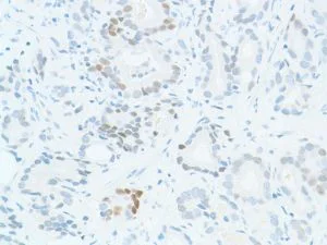 Immunohistochemistry (Formalin/PFA-fixed paraffin-embedded sections) - Anti-SOX2 antibody [SP76] - N-terminal, prediluted (AB101547)