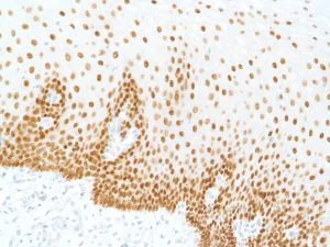Immunohistochemistry (Formalin/PFA-fixed paraffin-embedded sections) - Anti-SOX2 antibody [SP76] - N-terminal, prediluted (AB101547)