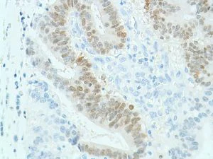 Immunohistochemistry (Formalin/PFA-fixed paraffin-embedded sections) - Anti-SOX2 antibody [SP76] - N-terminal, prediluted (AB101547)