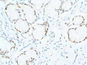 Immunohistochemistry (Formalin/PFA-fixed paraffin-embedded sections) - Anti-SOX2 antibody [SP76] - N-terminal, prediluted (AB101547)