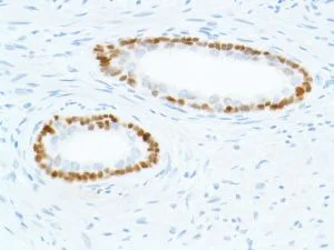 Immunohistochemistry (Formalin/PFA-fixed paraffin-embedded sections) - Anti-SOX2 antibody [SP76] - N-terminal, prediluted (AB101547)