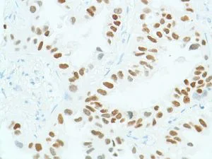 Immunohistochemistry (Formalin/PFA-fixed paraffin-embedded sections) - Anti-SOX2 antibody [SP76] - N-terminal, prediluted (AB101547)
