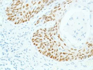 Immunohistochemistry (Formalin/PFA-fixed paraffin-embedded sections) - Anti-SOX2 antibody [SP76] - N-terminal, prediluted (AB101547)