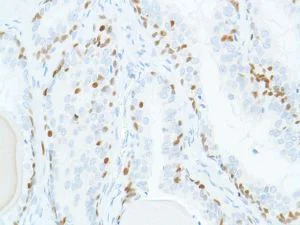 Immunohistochemistry (Formalin/PFA-fixed paraffin-embedded sections) - Anti-SOX2 antibody [SP76] - N-terminal, prediluted (AB101547)