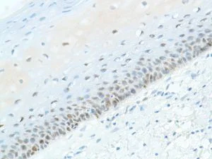 Immunohistochemistry (Formalin/PFA-fixed paraffin-embedded sections) - Anti-SOX2 antibody [SP76] - N-terminal, prediluted (AB101547)