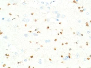 Immunohistochemistry (Formalin/PFA-fixed paraffin-embedded sections) - Anti-SOX2 antibody [SP76] - N-terminal, prediluted (AB101547)
