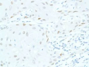 Immunohistochemistry (Formalin/PFA-fixed paraffin-embedded sections) - Anti-SOX2 antibody [SP76] - N-terminal, prediluted (AB101547)