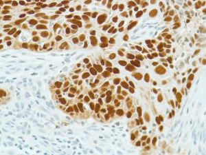Immunohistochemistry (Formalin/PFA-fixed paraffin-embedded sections) - Anti-SOX2 antibody [SP76] - N-terminal, prediluted (AB101547)