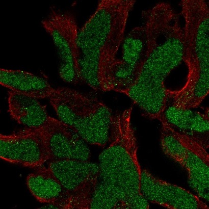 Immunocytochemistry/ Immunofluorescence - Anti-SOX21 antibody (AB221459), expandable thumbnail