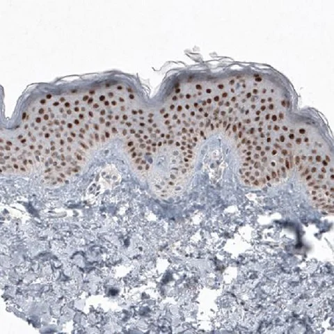 Immunohistochemistry (Formalin/PFA-fixed paraffin-embedded sections) - Anti-SOX21 antibody [CL4681] (AB220025)