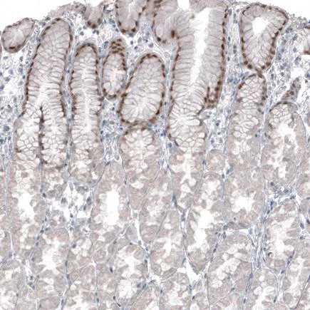 Immunohistochemistry (Formalin/PFA-fixed paraffin-embedded sections) - Anti-SOX21 antibody [CL4688] (AB220024)