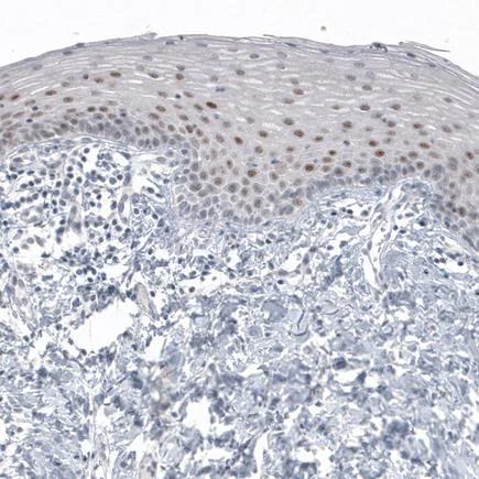 Immunohistochemistry (Formalin/PFA-fixed paraffin-embedded sections) - Anti-SOX21 antibody [CL4688] (AB220024)