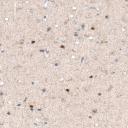 Immunohistochemistry (Formalin/PFA-fixed paraffin-embedded sections) - Anti-SOX21 antibody [CL4688] (AB220024)