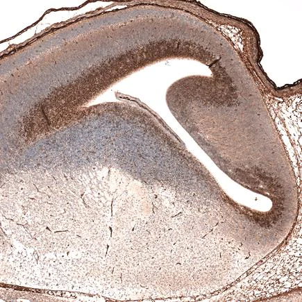 Immunohistochemistry (Formalin/PFA-fixed paraffin-embedded sections) - Anti-SOX21 antibody [CL4688] (AB220024)