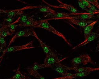 Immunocytochemistry/ Immunofluorescence - Anti-SOX3 antibody (AB183606)