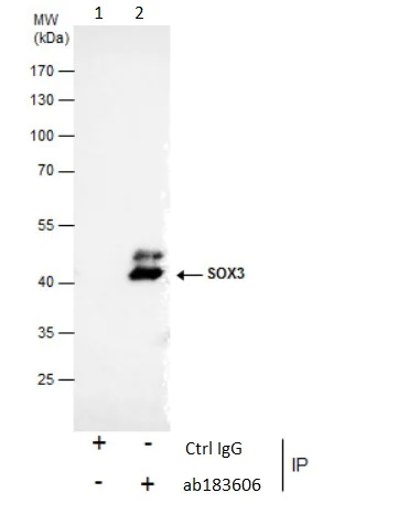 Immunoprecipitation - Anti-SOX3 antibody (AB183606)