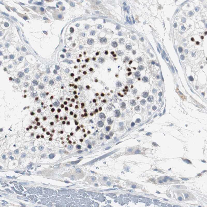 Immunohistochemistry (Formalin/PFA-fixed paraffin-embedded sections) - Anti-SOX30 antibody (AB272553)