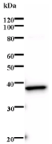 Western blot - Anti-SOX4 antibody [154C4a] (AB70598), expandable thumbnail