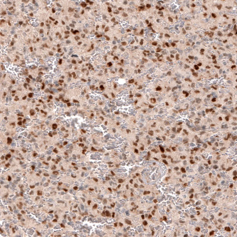 Immunohistochemistry (Formalin/PFA-fixed paraffin-embedded sections) - Anti-SOX4 antibody [CL5634] (AB243041)