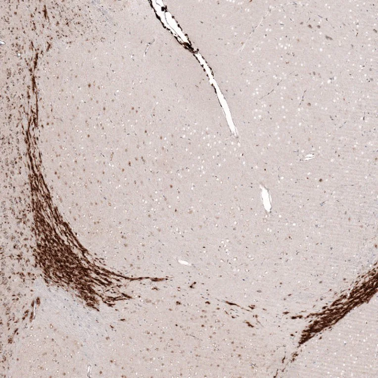 Immunohistochemistry (Formalin/PFA-fixed paraffin-embedded sections) - Anti-SOX4 antibody [CL5634] (AB243041)