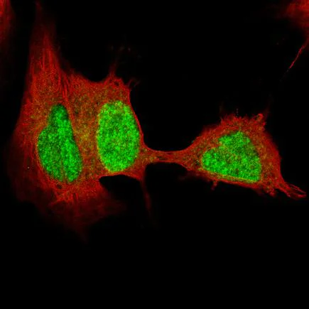 Immunocytochemistry/ Immunofluorescence - Anti-SOX4 antibody [CL5665] (AB243739)