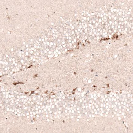 Immunohistochemistry (Formalin/PFA-fixed paraffin-embedded sections) - Anti-SOX4 antibody [CL5665] (AB243739)