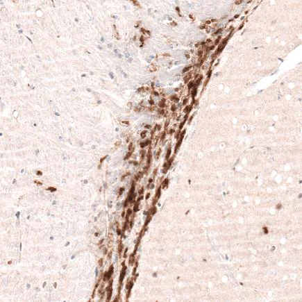 Immunohistochemistry (Formalin/PFA-fixed paraffin-embedded sections) - Anti-SOX4 antibody [CL5665] (AB243739)