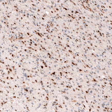 Immunohistochemistry (Formalin/PFA-fixed paraffin-embedded sections) - Anti-SOX4 antibody [CL5665] (AB243739)