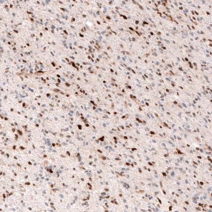 Immunohistochemistry (Formalin/PFA-fixed paraffin-embedded sections) - Anti-SOX4 antibody [CL5665] (AB243739)