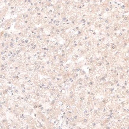 Immunohistochemistry (Formalin/PFA-fixed paraffin-embedded sections) - Anti-SOX4 antibody [CL5665] (AB243739)