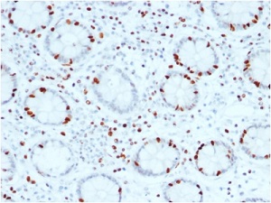 Immunohistochemistry (Formalin/PFA-fixed paraffin-embedded sections) - Anti-SOX4 antibody [SOX4/2540] (AB236557), expandable thumbnail