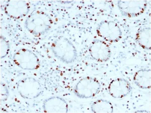 Immunohistochemistry (Formalin/PFA-fixed paraffin-embedded sections) - Anti-SOX4 antibody [SOX4/2540] (AB236557)