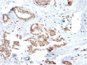 Immunohistochemistry (Formalin/PFA-fixed paraffin-embedded sections) - Anti-SOX4 antibody [SOX4/2540] (AB236557), expandable thumbnail