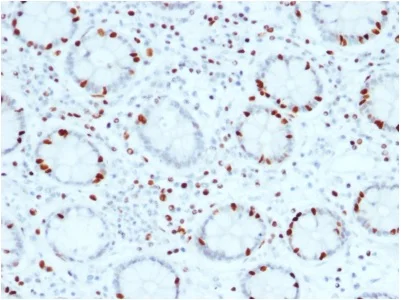 Immunohistochemistry (Formalin/PFA-fixed paraffin-embedded sections) - Anti-SOX4 antibody [SOX4/2540] - BSA and Azide free (AB237903)