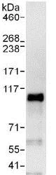 Immunoprecipitation - Anti-SOX6 antibody (AB125196)