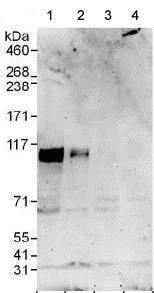 Western blot - Anti-SOX6 antibody (AB125196)