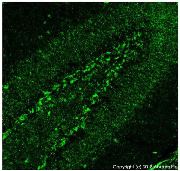 Immunohistochemistry (PFA fixed) - Anti-SOX6 antibody (AB30455)