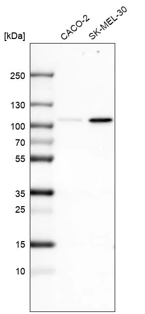 Western blot - Anti-SOX6 Antibody [CL5685] (AB327119)