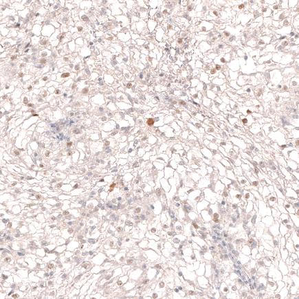 Immunohistochemistry (Formalin/PFA-fixed paraffin-embedded sections) - Anti-SOX6 antibody [CL5690] (AB243576)