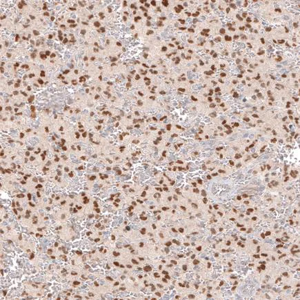 Immunohistochemistry (Formalin/PFA-fixed paraffin-embedded sections) - Anti-SOX6 antibody [CL5690] (AB243576)