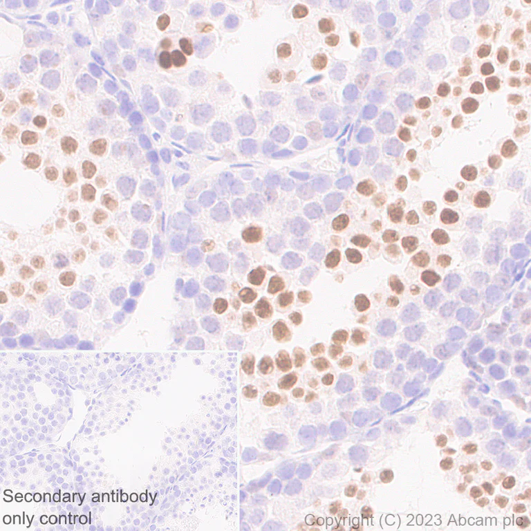 Immunohistochemistry (Formalin/PFA-fixed paraffin-embedded sections) - Anti-SOX6 antibody [EPR24986-148] (AB314209)