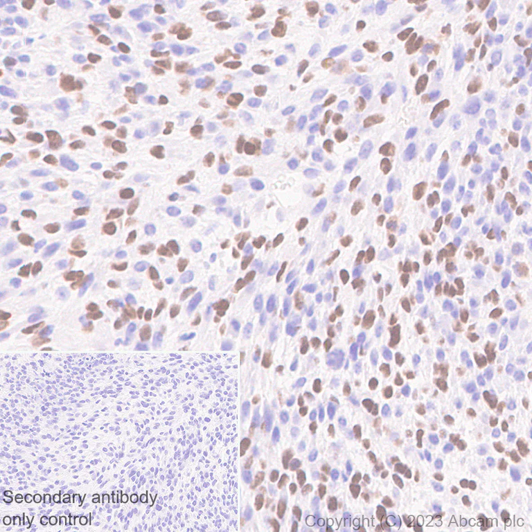 Immunohistochemistry (Formalin/PFA-fixed paraffin-embedded sections) - Anti-SOX6 antibody [EPR24986-148] (AB314209)