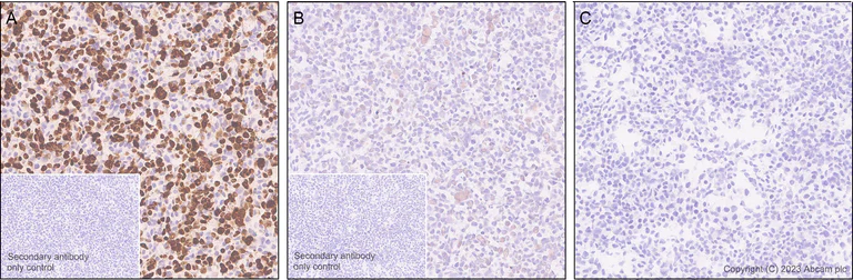 Immunohistochemistry (Formalin/PFA-fixed paraffin-embedded sections) - Anti-SOX6 antibody [EPR24986-148] (AB314209)