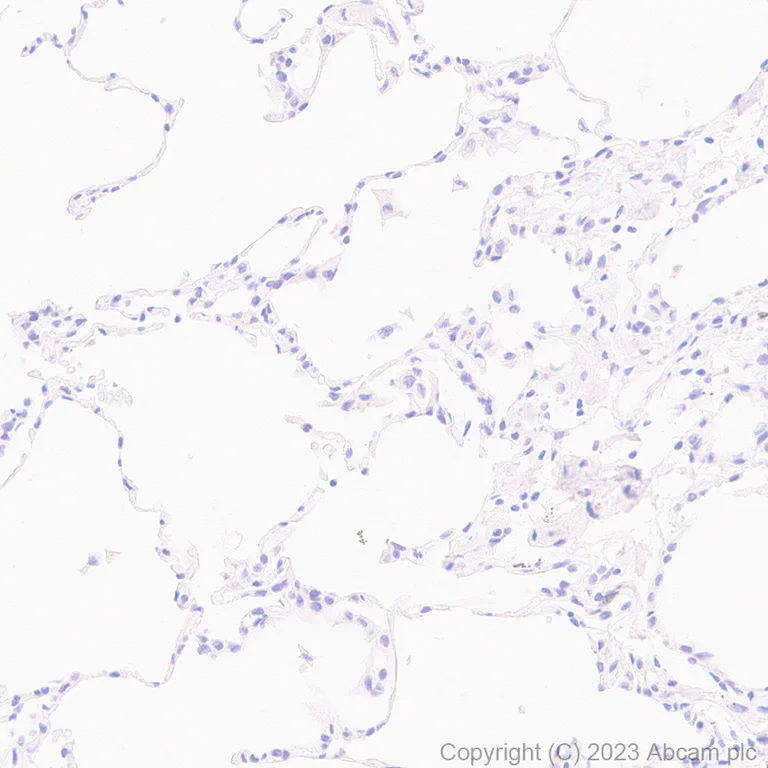 Immunohistochemistry (Formalin/PFA-fixed paraffin-embedded sections) - Anti-SOX6 antibody [EPR24986-148] (AB314209)
