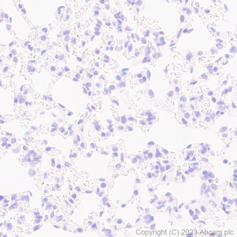 Immunohistochemistry (Formalin/PFA-fixed paraffin-embedded sections) - Anti-SOX6 antibody [EPR24986-148] (AB314209)
